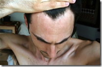 hair loss reason