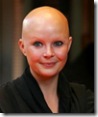 female alopecia